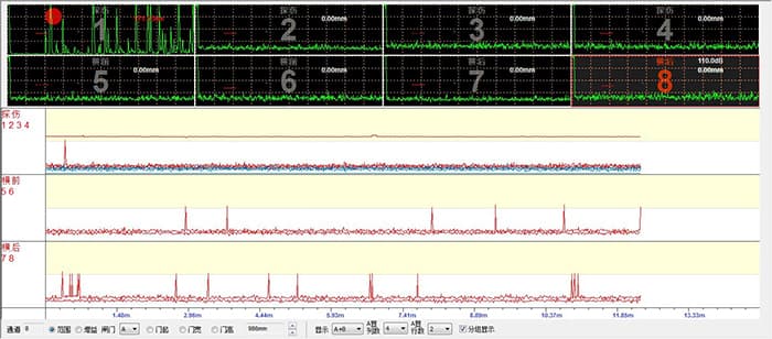 超聲A掃描.jpg 超聲A掃描.jpg